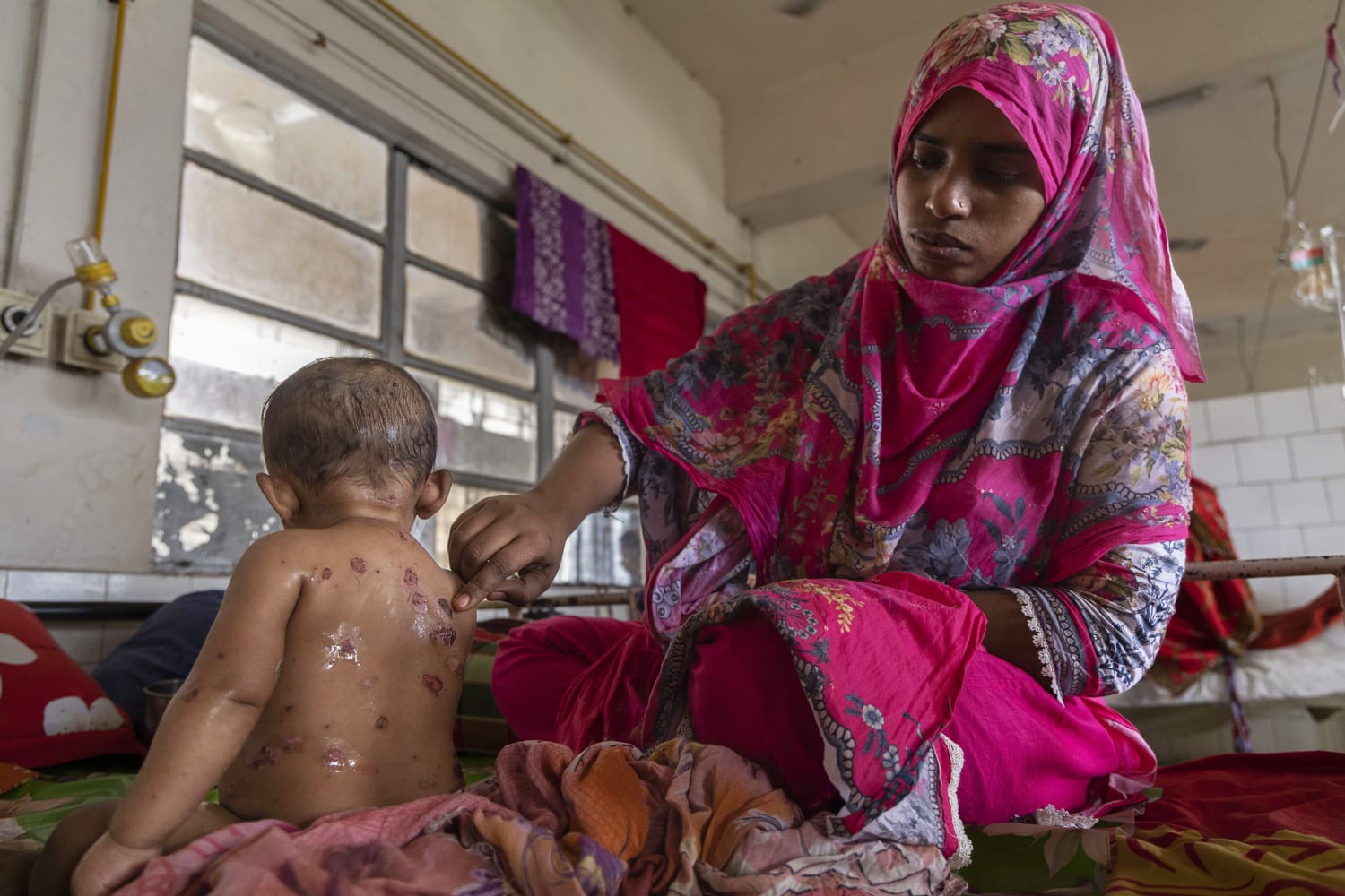 bangladesh-measles-outbreak-over-500-children-dead-in-a-crisis-the-world-is-ignoring