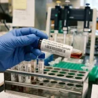 Second Hantavirus Case Confirmed in Spain: