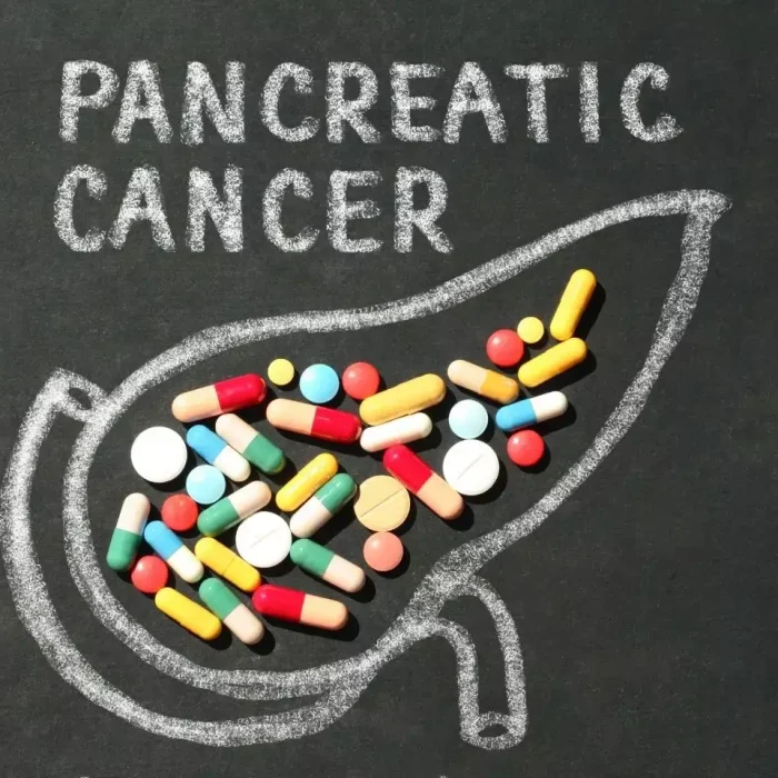 Pancreatic Cancer Drug Breakthrough: Daraxonrasib Sparks Surge in US Patient Demand