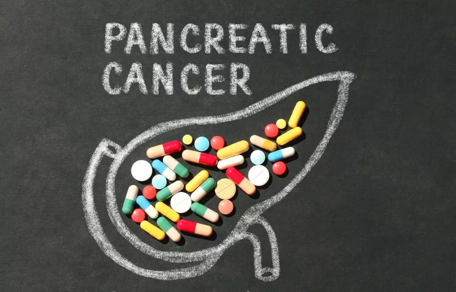 pancreatic-cancer-drug-breakthrough-daraxonrasib-sparks-surge-in-us-patient-demand
