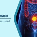 Rectal Cancer Warning Signs Every Young Adult Should Know as Cases Surge in 30s and 40s 8 Rectal Cancer Warning Signs Every Young Adult
