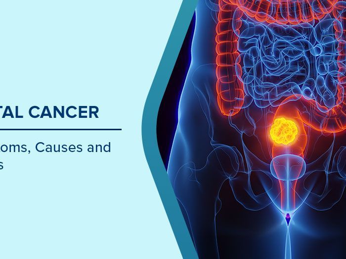 Rectal Cancer Warning Signs Every Young Adult Should Know as Cases Surge in 30s and 40s