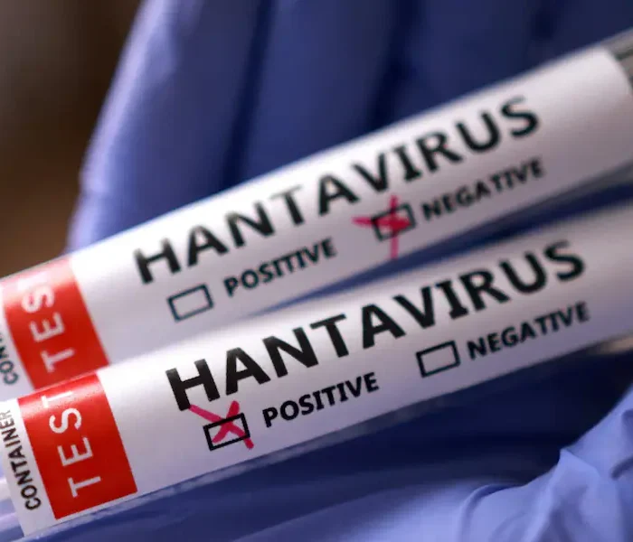 Hantavirus Vaccines and Treatments in Development as Cruise Ship Outbreak Sparks New Urgency