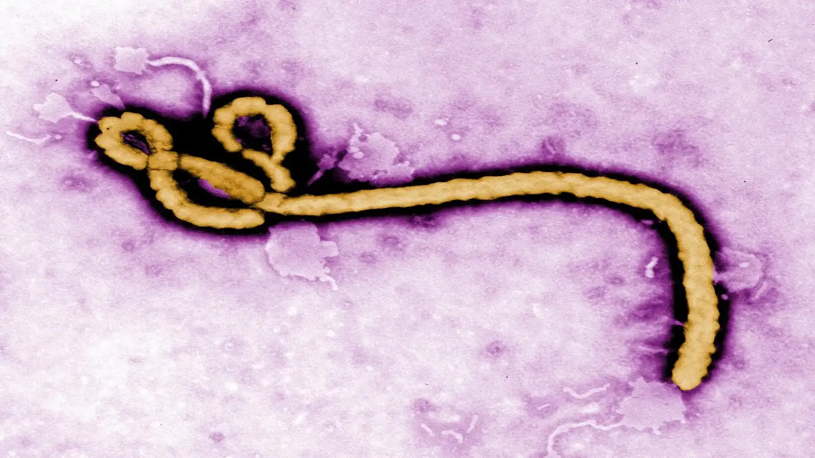 ebola-outbreak-becomes-third-largest-in-history-as-rare-strain-spreads-in-congo