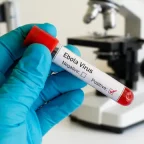 Bundibugyo Virus Outbreak: Ebola Cases Surge Across DRC and Uganda 6 Bundibugyo Virus Outbreak