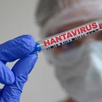 Minnesota Resident Possibly Exposed to Hantavirus After Contact With Cruise Ship Passenger 6 Minnesota Resident Possibly Exposed to Hantavirus