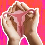 PCOS Officially Renamed PMOS