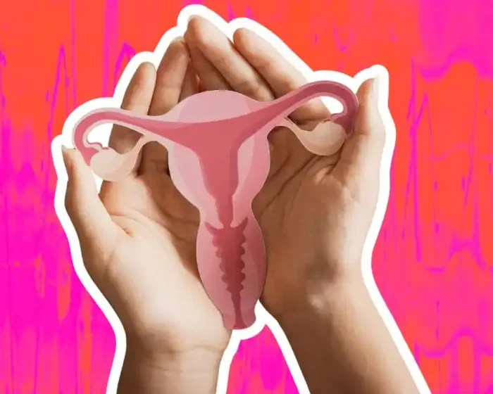 PCOS Officially Renamed PMOS: The End of Decades of Misleading Science