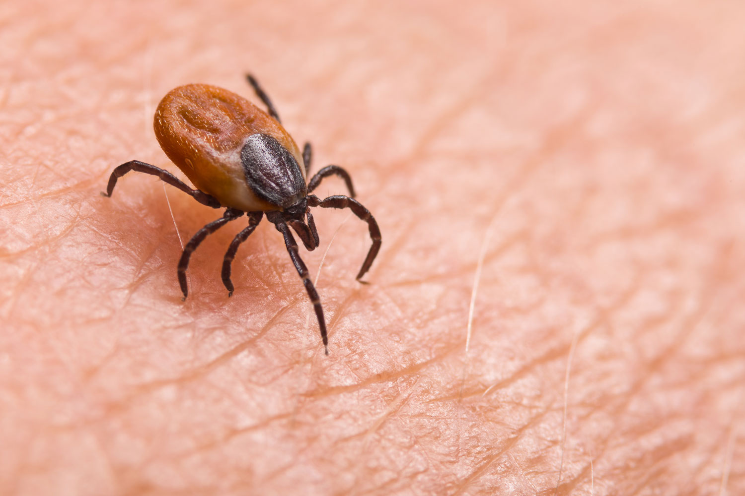 mild-winter-means-more-ticks-this-year-your-complete-guide-to-staying-safe