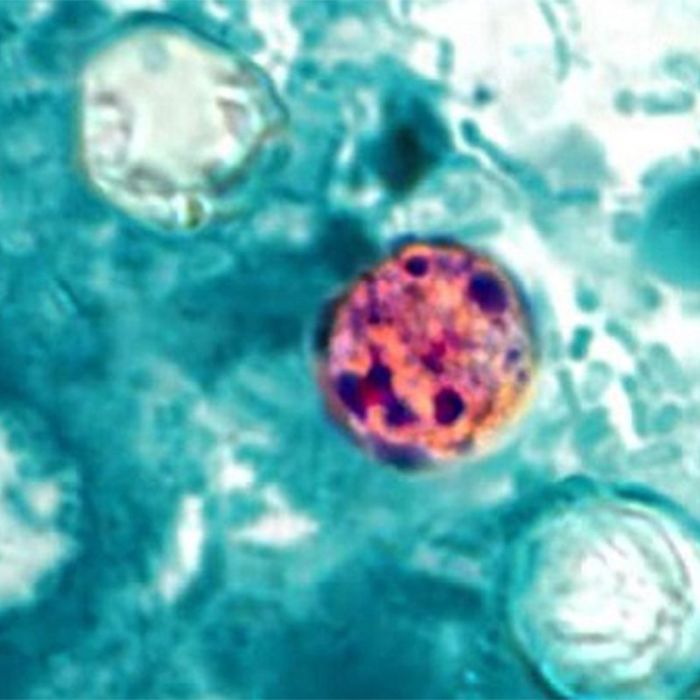 Cyclosporiasis Outbreak Hits Michigan: What You Need to Know as Cases Top 300