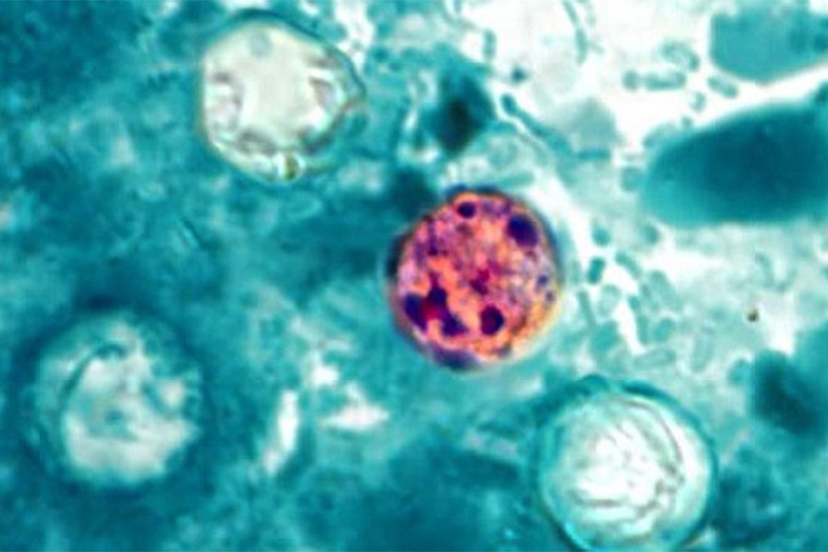 cyclosporiasis-outbreak-hits-michigan-what-you-need-to-know-as-cases-top-300