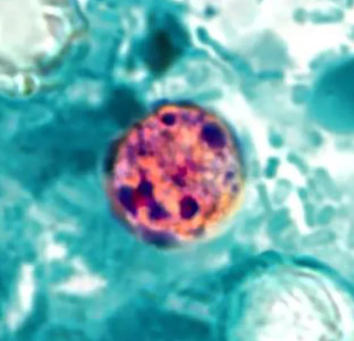 Health Alert: Parasite Causing “Explosive Diarrhea” Is Spreading Across Kentucky and Beyond