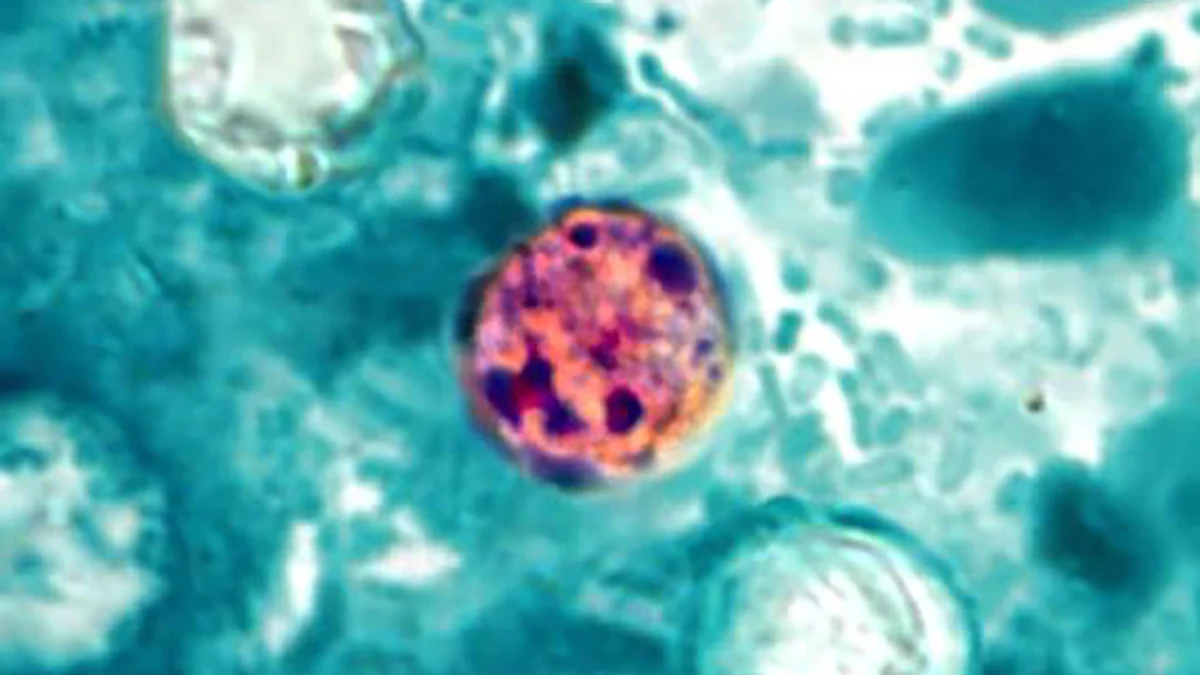 health-alert-parasite-causing-explosive-diarrhea-is-spreading-across-kentucky-and-beyond