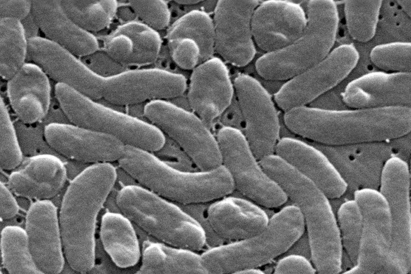 louisiana-reports-five-deaths-as-flesh-eating-bacteria-cases-climb-along-the-gulf