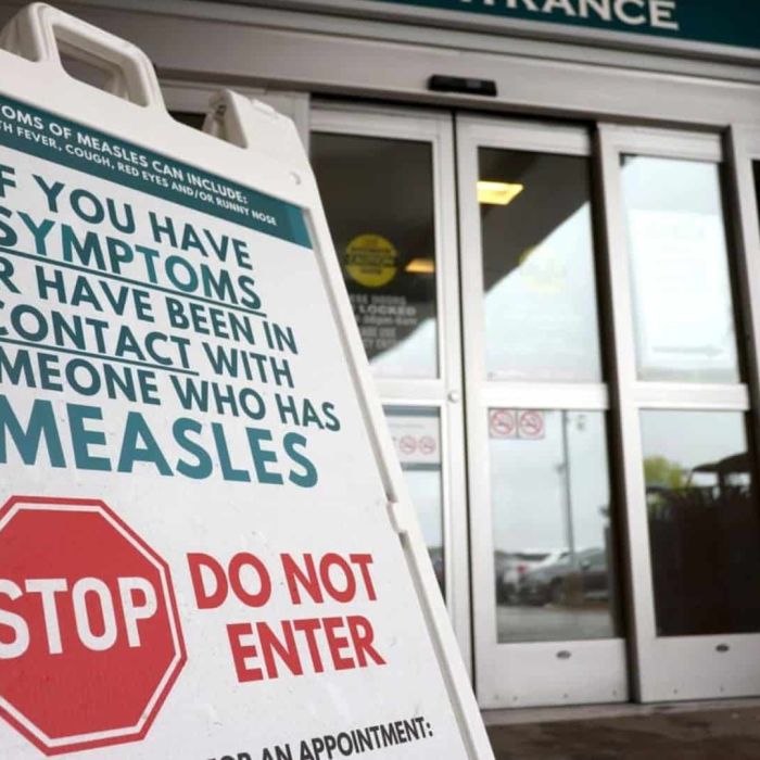 Measles Exposure Warning Issued for Warren Hospital Emergency Room Visitors