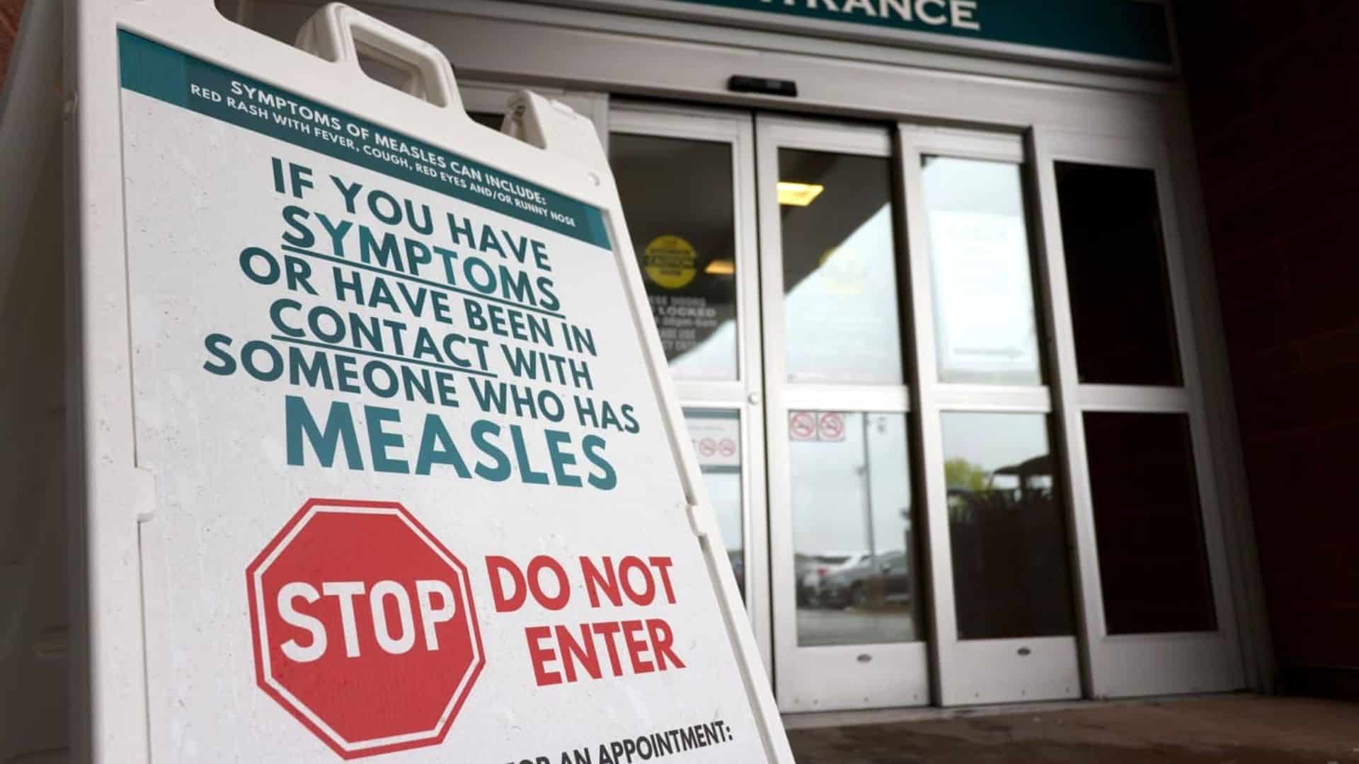 measles-exposure-warning-issued-for-warren-hospital-emergency-room-visitors