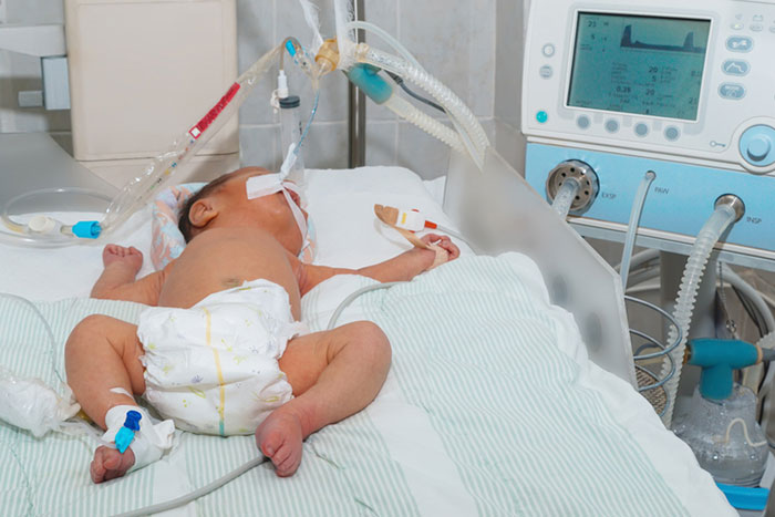 A Newborn on a Ventilator and a Courtroom Deadlock Over Who Decides His Care